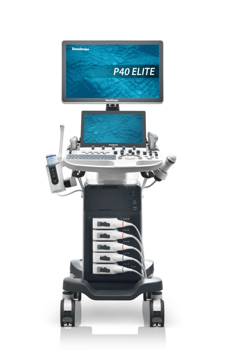 Ultraschallsystem SonoScape P40 Elite